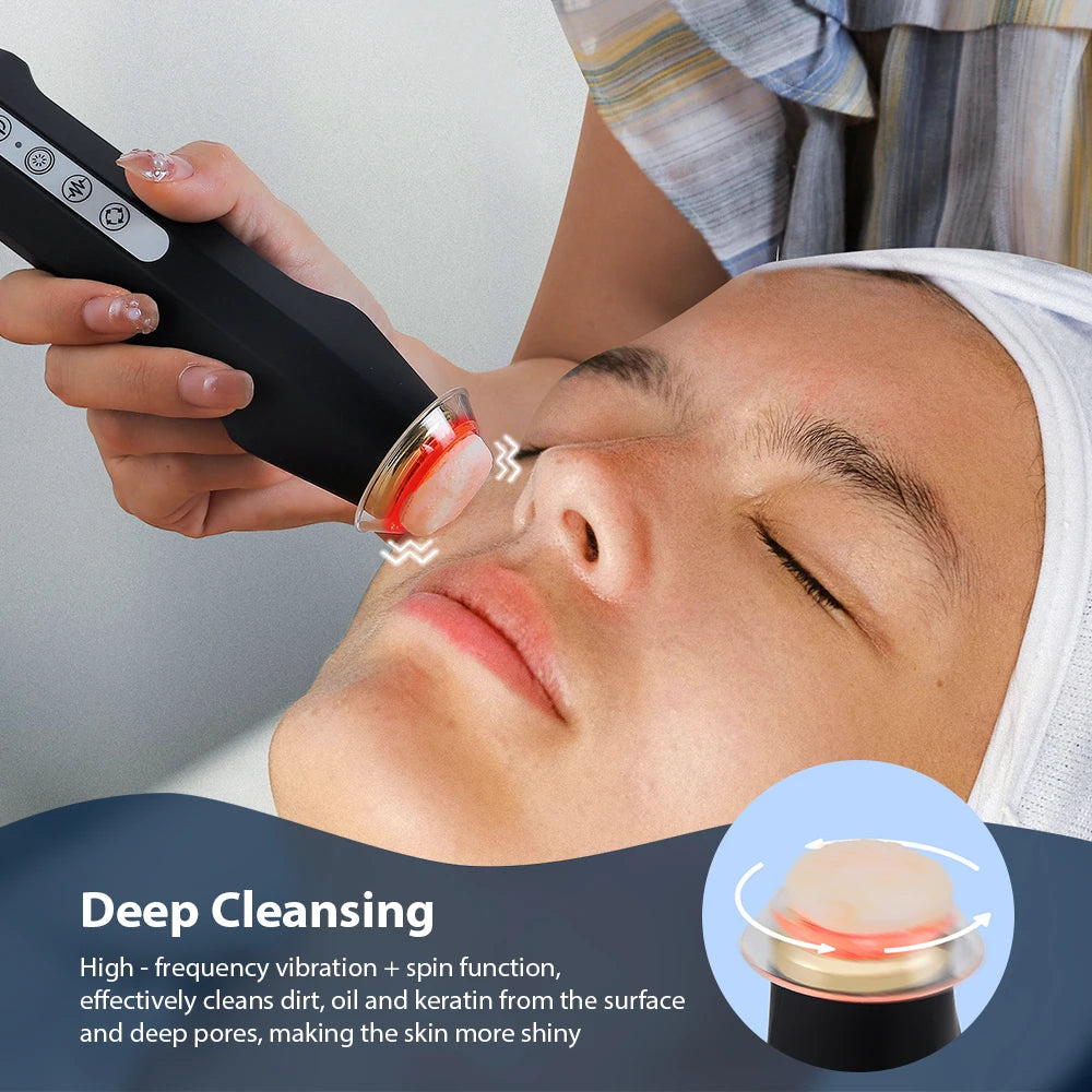 Oxygen Bubble Pen – Dispositivo Facial de Burbujas de Oxígeno CO2 con Terapia LED